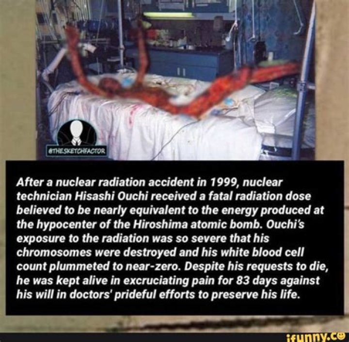 The True Story Of Hisashi Ouchi: A Shocking Nuclear Accident And Its Aftermath